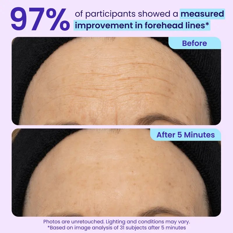 🔥NEW! Instant Lift Eye Gel – Anti-Aging for Puffiness, Bags, Wrinkles & Dark Circles