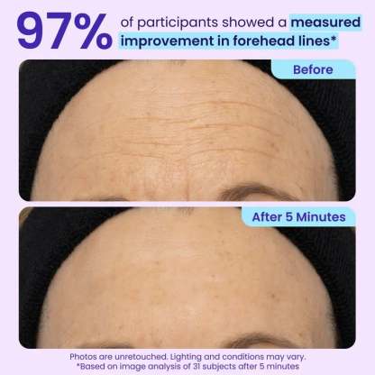 🔥NEW! Instant Lift Eye Gel – Anti-Aging for Puffiness, Bags, Wrinkles & Dark Circles