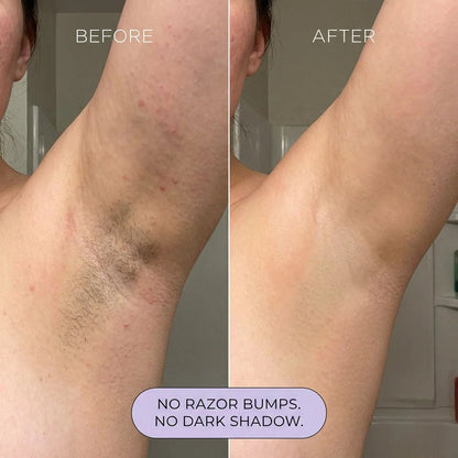🔥LAST DAY 50% OFF🧴OUR+ Hair Removal Mousse