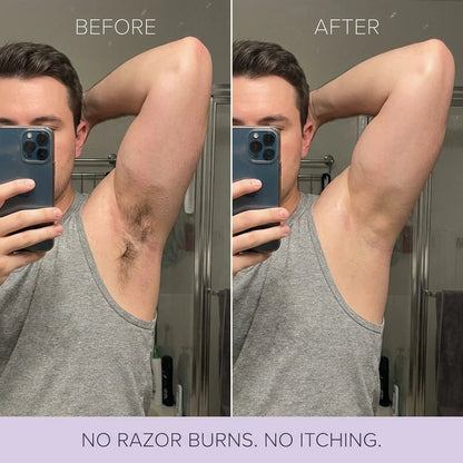 🔥LAST DAY 50% OFF🧴OUR+ Hair Removal Mousse