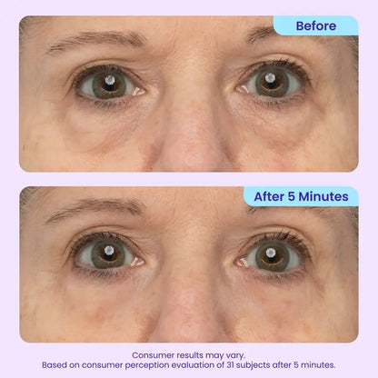 🔥NEW! Instant Lift Eye Gel – Anti-Aging for Puffiness, Bags, Wrinkles & Dark Circles