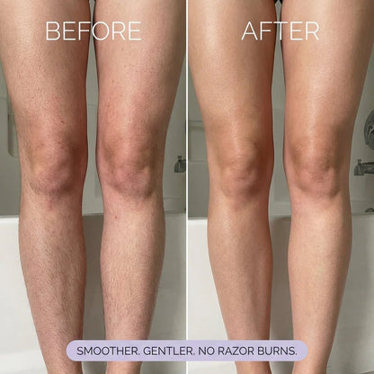 🔥LAST DAY 50% OFF🧴OUR+ Hair Removal Mousse