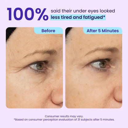 🔥NEW! Instant Lift Eye Gel – Anti-Aging for Puffiness, Bags, Wrinkles & Dark Circles