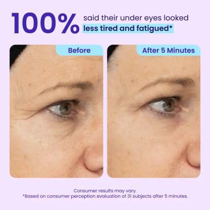 🔥NEW! Instant Lift Eye Gel – Anti-Aging for Puffiness, Bags, Wrinkles & Dark Circles